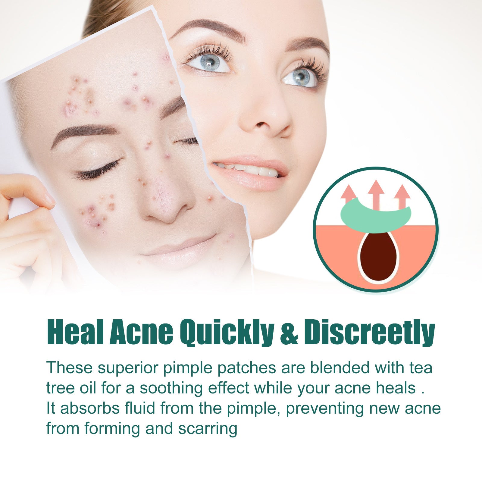 Moon Acne Patches with Salicylic Acid – Colorful Blemish Dots