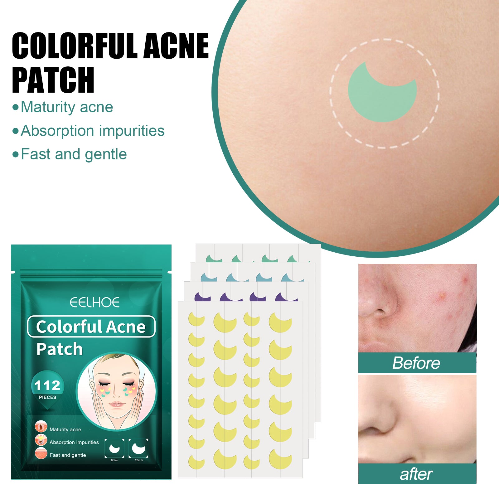 Moon Acne Patches with Salicylic Acid – Colorful Blemish Dots